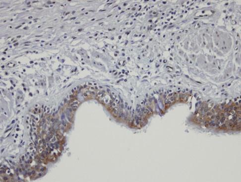 SHKBP1 antibody [N2C2], Internal