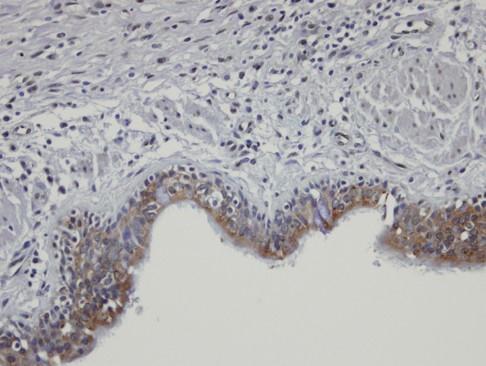 SHKBP1 antibody