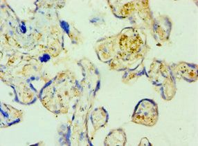SHMT1 Antibody