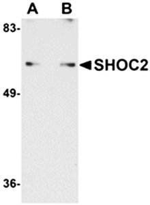 SHOC2 Antibody