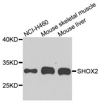 SHOX2 antibody