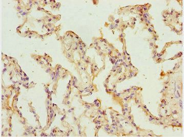 SHOX2 Antibody