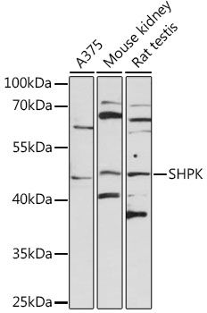 SHPK antibody