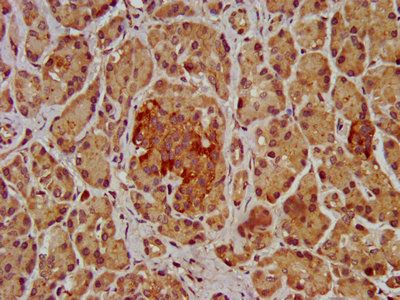 SHROOM2 Antibody