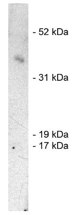 Rabbit anti Human SIAH1, E3 Ubiquitin Ligase