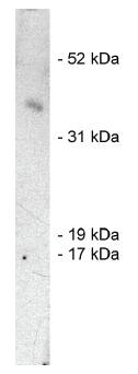 Rabbit anti Human SIAH1, E3 Ubiquitin Ligase