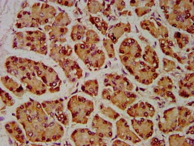 SIAH2 Antibody