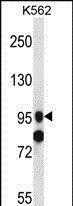 SIDT1 antibody