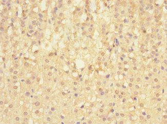 SIGIRR Antibody