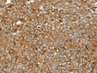 SIGLEC11 antibody