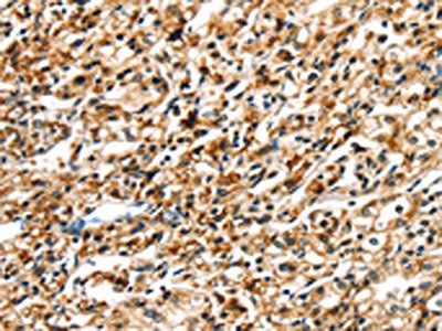 SIGLEC12 antibody