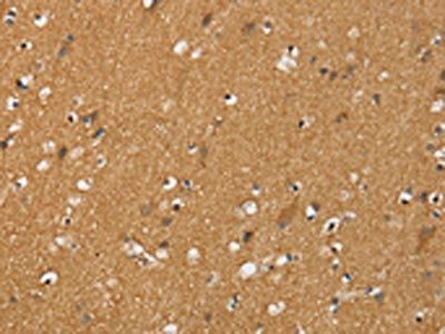 SIGLEC14 Antibody