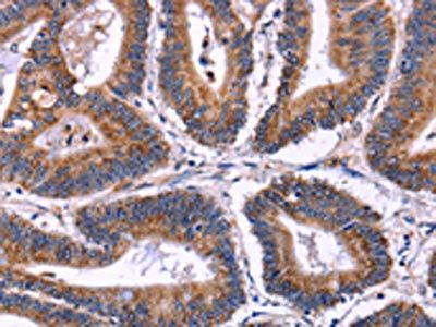 SIGLEC5 Antibody