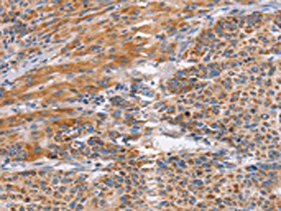 SIGLEC6 Antibody