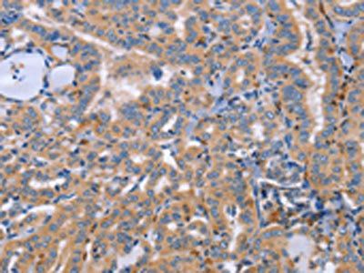 SIGLEC7 antibody