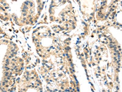 SIGLEC8 antibody