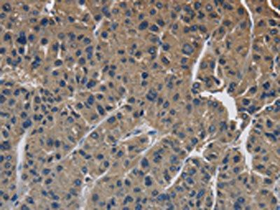 SIGMAR1 Antibody