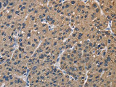 SIGMAR1 Antibody