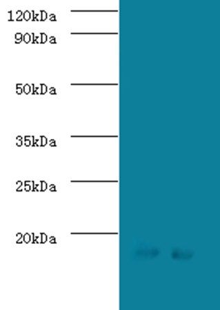 Signal recognition particle 19 kDa protein antibody