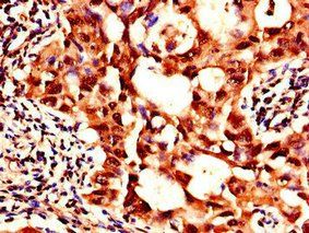 SIK1 Antibody