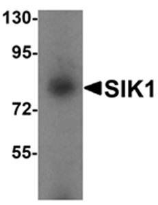 SIK1 Antibody
