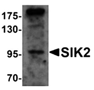 SIK2 Antibody