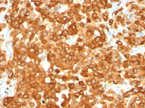 gp100 / Melanosome / PMEL17 / SILV (Melanoma Marker) Antibody