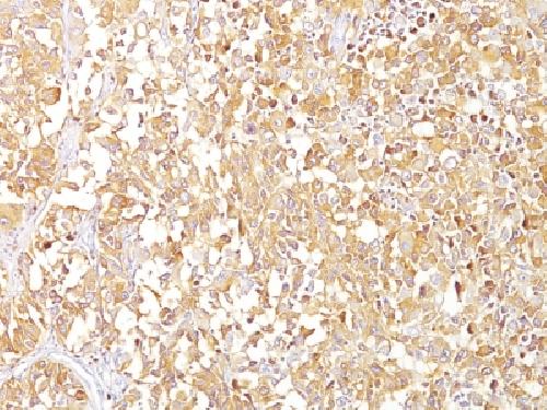 gp100 / Melanosome / PMEL17 / SILV (Melanoma Marker) Antibody