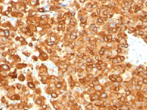 gp100 / Melanosome / PMEL17 / SILV (Melanoma Marker) Antibody