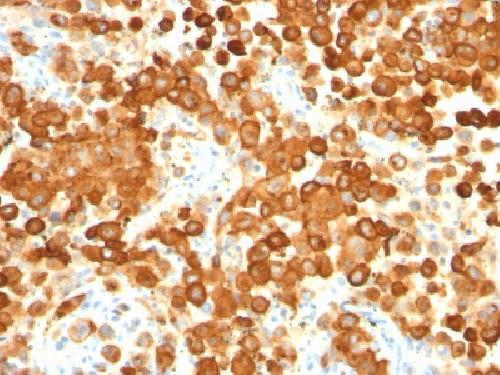 gp100 / Melanosome / PMEL17 / SILV (Melanoma Marker) Antibody