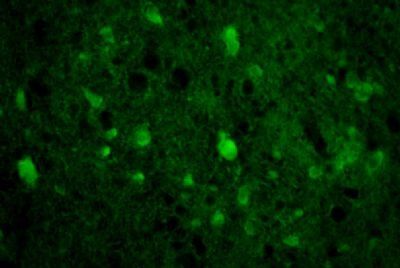 SIM1 Rabbit Polyclonal Antibody
