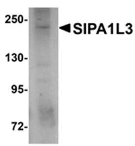 SIPA1L3 Antibody