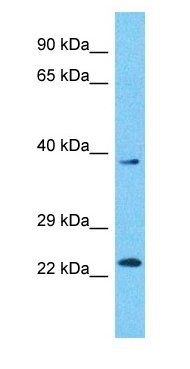 SIR3 antibody