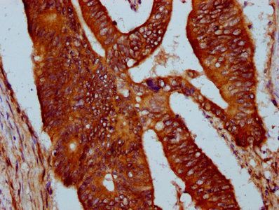 SIRPB1 Antibody
