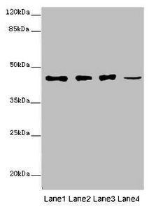 SIRPB1 antibody