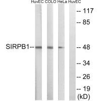 SIRPB1 antibody
