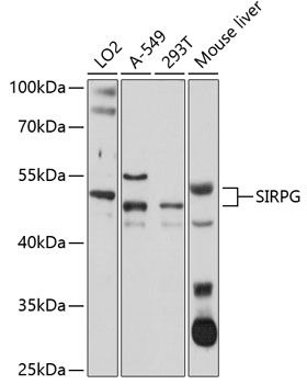 SIRPG antibody