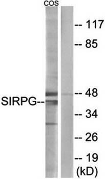 SIRPG antibody