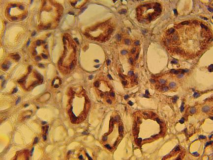 Rabbit anti Human Sirt1 Protein (Human)