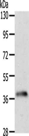 SIRT2 antibody
