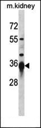 SIRT3 antibody