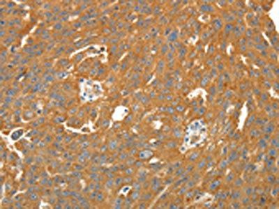 SIRT4 Antibody