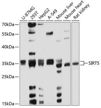 SIRT5 antibody