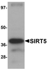 SIRT5 Antibody