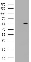 SIVA (SIVA1) antibody