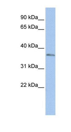 SIX3 antibody