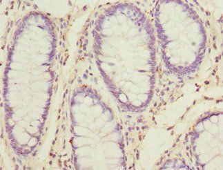 SKAP2 Antibody