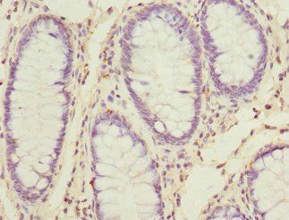 SKAP2 antibody