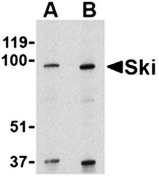 Ski Antibody