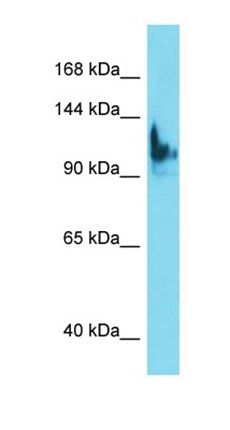 SKIDA1 antibody